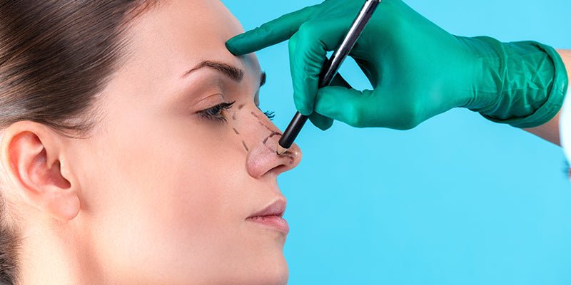 Rinoplastia Abierta Vs Rinoplastia Cerrada Planifiquemos Tu Mejor Op